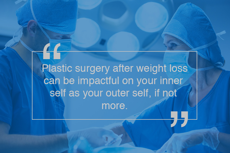Plastic surgery after major weight loss can be impactful on your inner self as your outer self, if not more.