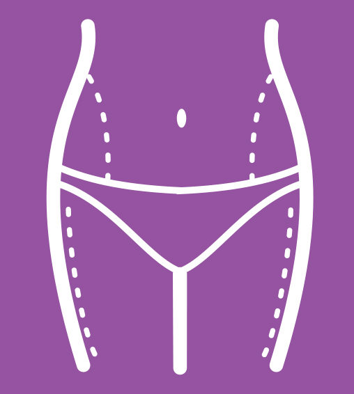Browse the Liposuction Gallery of Before and After Photos of Dr. Rafael Camberos' patients from Plastic Surgery Tijuana Center.
