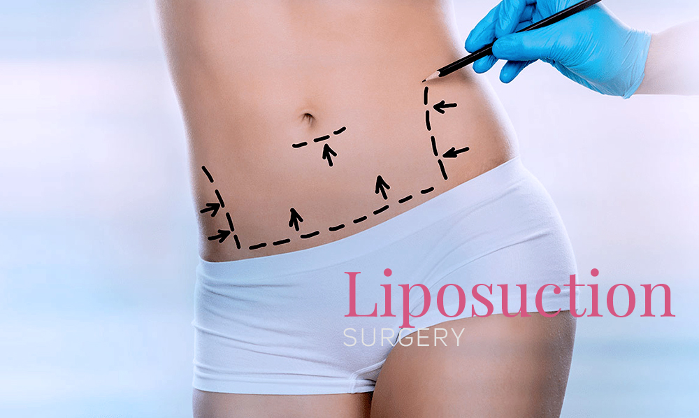 Liposuction surgery, is one of the most popular cosmetic surgery procedures, in Plastic Surgery Tijuana to remove fat deposits from many areas of the body.