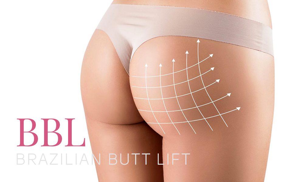 What Is a Brazilian Butt Lift and How Does It Work?