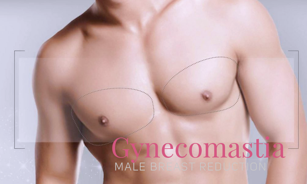 Plastic Surgery Tijuana, founded by Dr. Rafael Camberos, offers male breast reduction or gynecomastia.